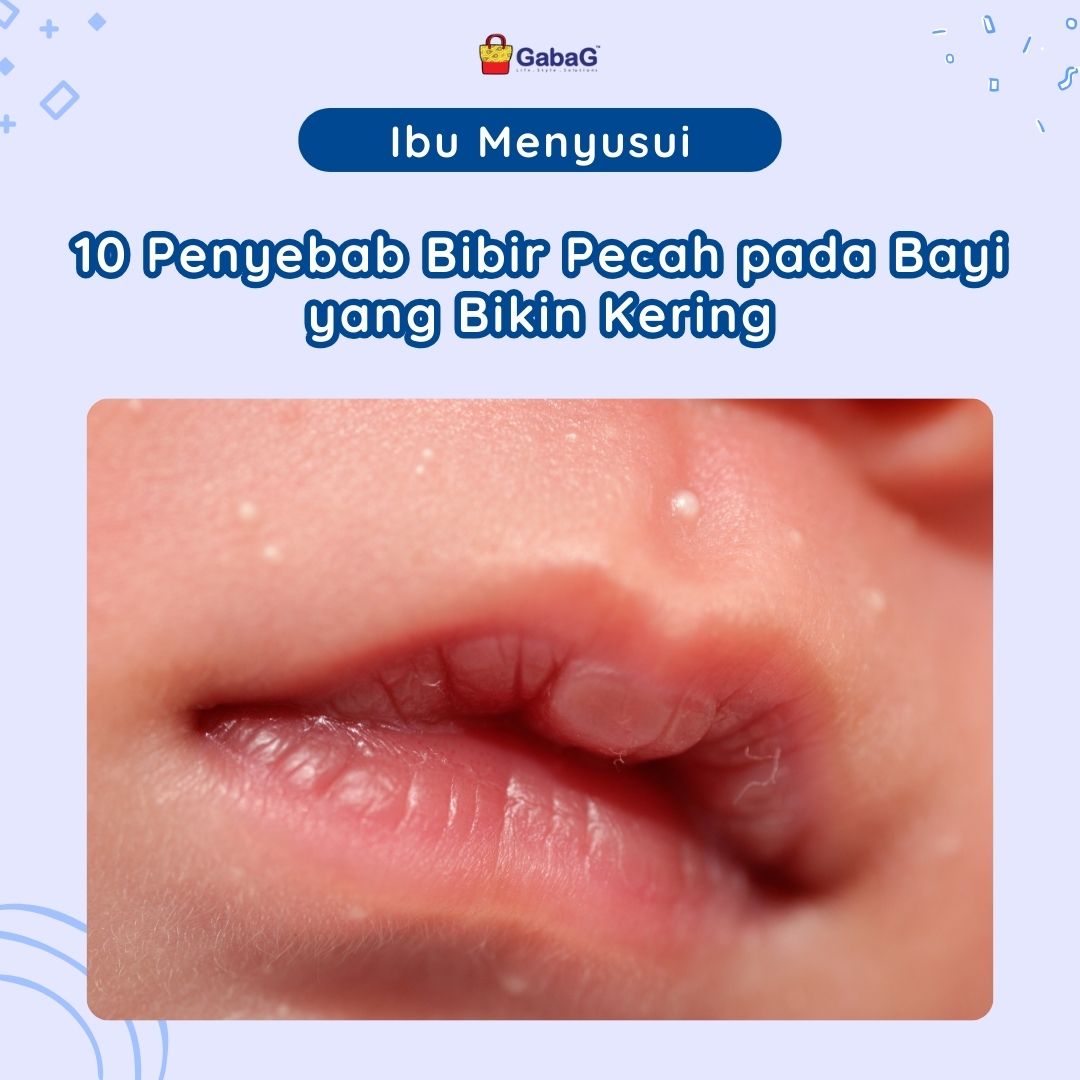 10 Penyebab Bibir Pecah pada Bayi yang Bikin Kering Beserta Cara Mengatasinya 1