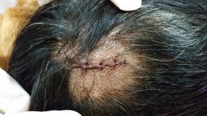7 Pilihan Cairan Pembersih Luka yang Tepat: Panduan Lengkap dan Aman 3 20151027 182455 300x169 1