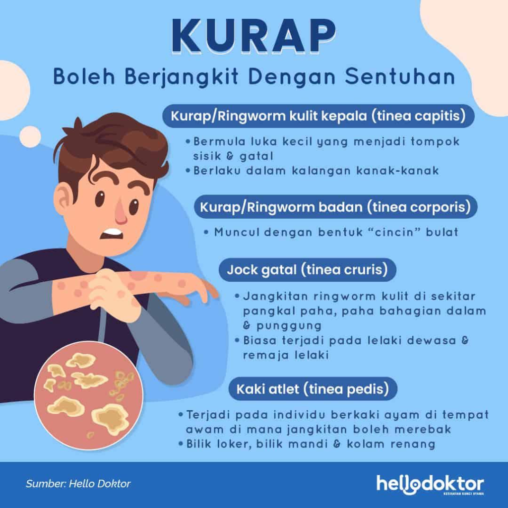 Benjolan di Selangkangan, Ini 9 Penyebab dan Penanganannya yang Wajib Diketahui 2 75b38753 211117 infographic penyakit kurap 1024x1024 1