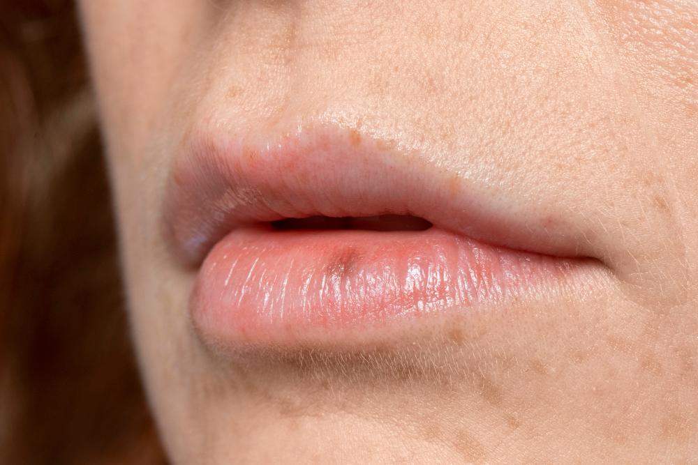 9ab60ba5 close up face pores