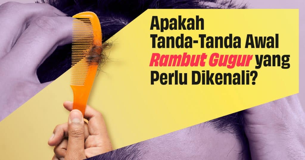 Inilah Ragam Penyebab Rambut Rontok yang Tak Anda Duga dan Cara Mengatasinya 3 AUG WEBBLOG VISUAL 02 1024x538 1