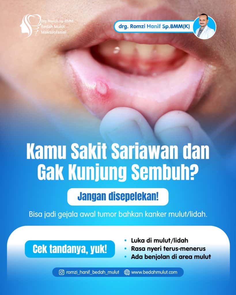 Kelenjar Getah Bening: Anatomi, Fungsi, dan Gangguannya: Panduan Lengkap 3 Post 8 1 819x1024 1