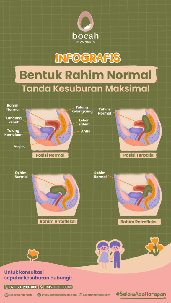 Bentuk Rahim, Mana yang Normal dan Mana yang Tidak? Panduan Lengkap Medis 1 bentuk rahom normal jp 579x1024 1