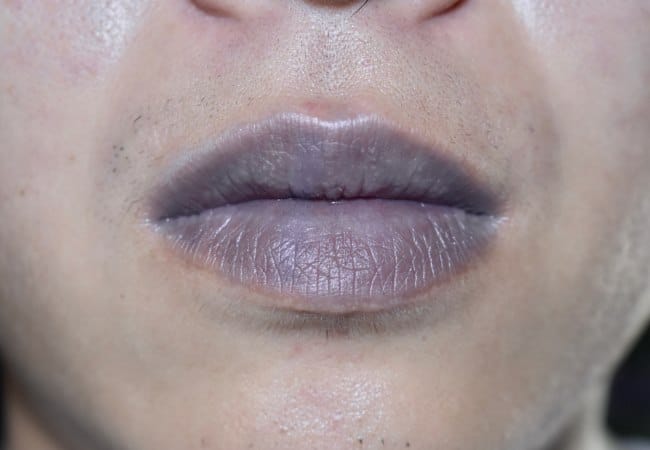 bibir hitam