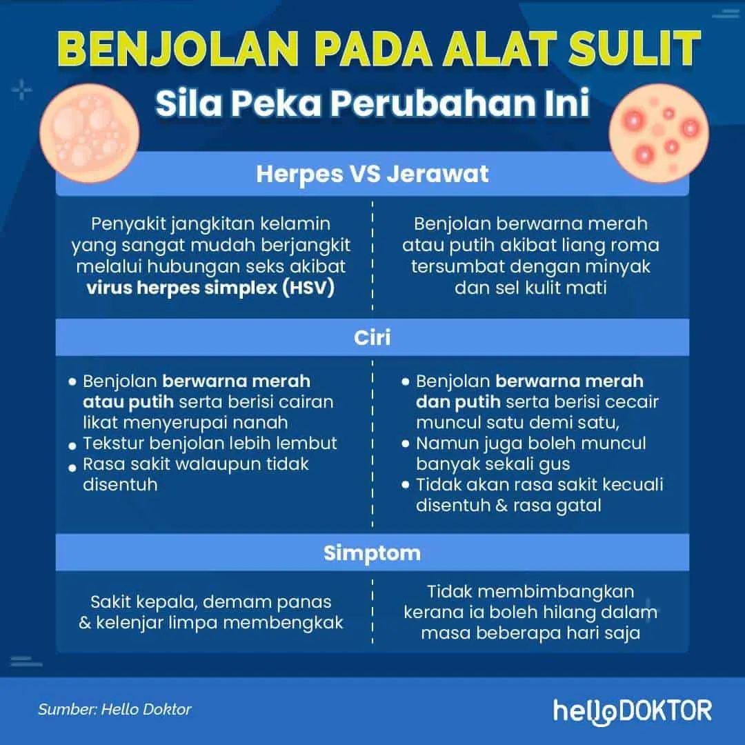 10 Penyebab Benjolan di Penis dan Pengobatannya yang Wajib Diketahui 2 c9e86bcf 187450547 2712834502310405 3403510490270021874 n