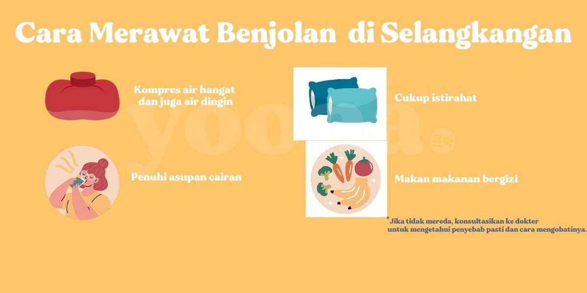 Benjolan di Selangkangan, Ini 9 Penyebab dan Penanganannya yang Wajib Diketahui 1 cara menghilangkan benjolan di selangkangan secara alami