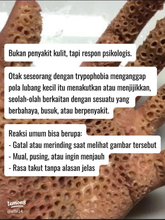 Merinding Jijik Melihat Foto Ini? Mungkin Anda Mengidap Trypophobia: Gejala & Fakta 1