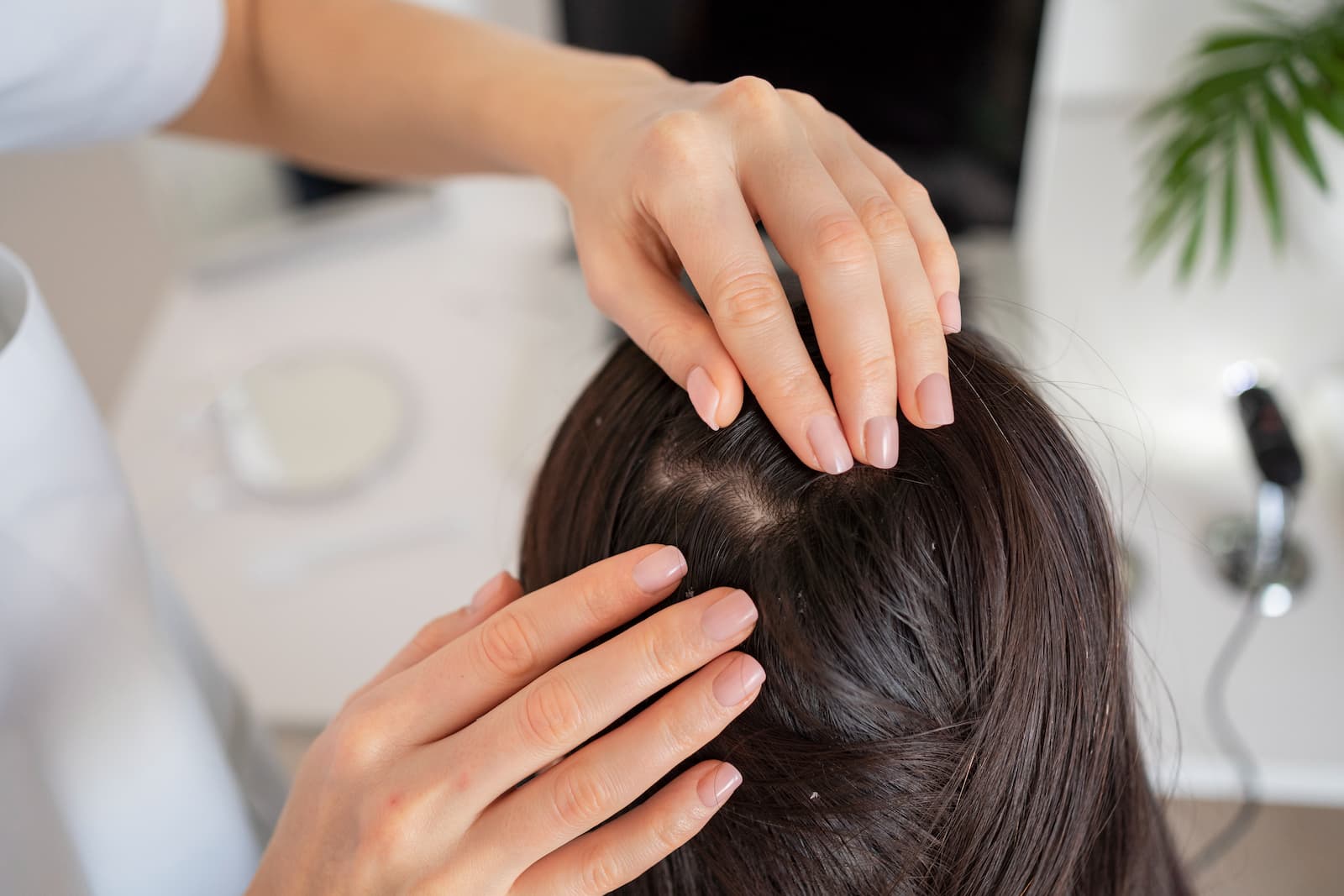 Mengenal Fungsi Folikel Rambut serta Cara Merawatnya agar Tetap Sehat 2 folikel rambut mati