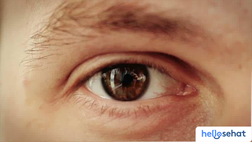 Berbagai Gejala Glaukoma yang Harus Anda Waspadai, Berdasarkan Jenisnya: Panduan Lengkap 1 glaucoma symtoms